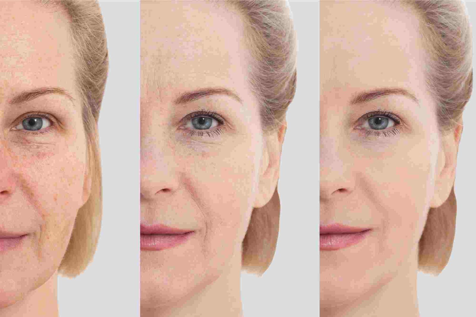 Cara Mengurangi Kerutan Wajah Secara Alami